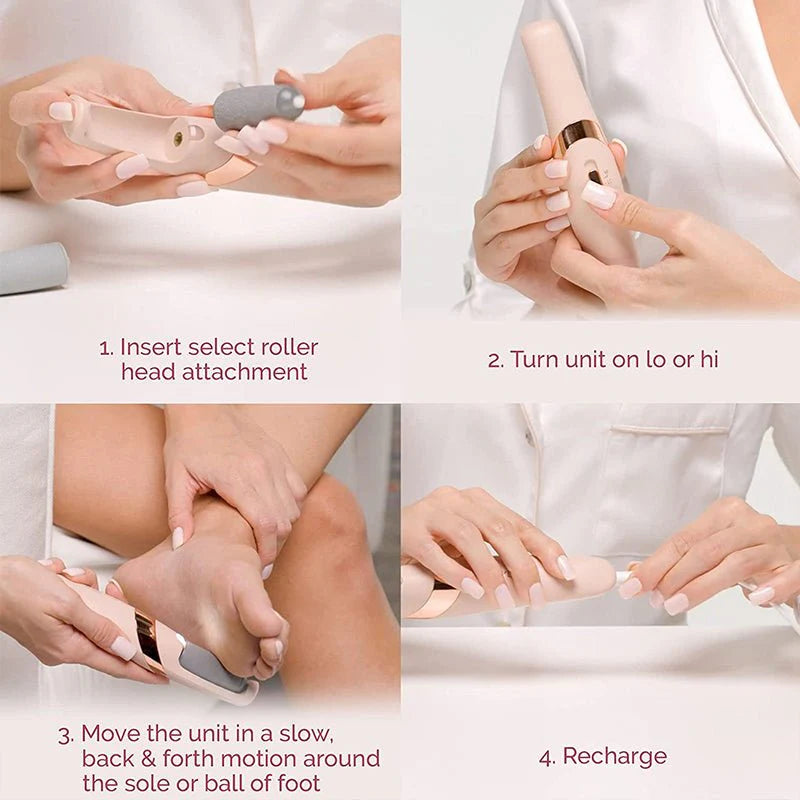 Callus Remover